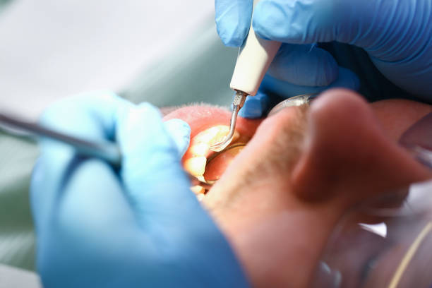 Best Emergency Broken Tooth Repair in Granite City, IL