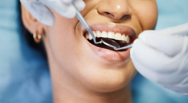 Best Emergency Tooth Extraction in Granite City, IL